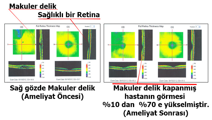 Göz Hastalıkları